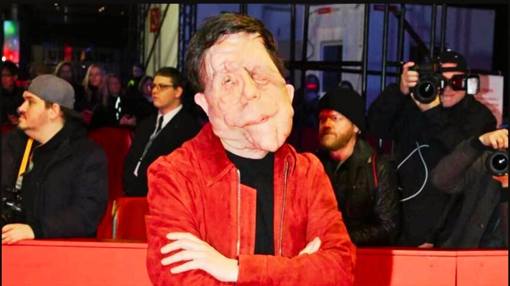 Adam Pearson Wife, Family & Net Worth 1