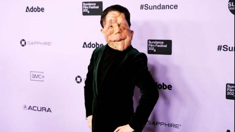 Adam Pearson Wife, Family & Net Worth 2